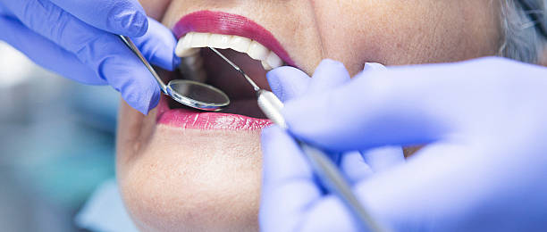 Best Broken or Cracked Tooth Emergency Dentist in Ivyland, PA
